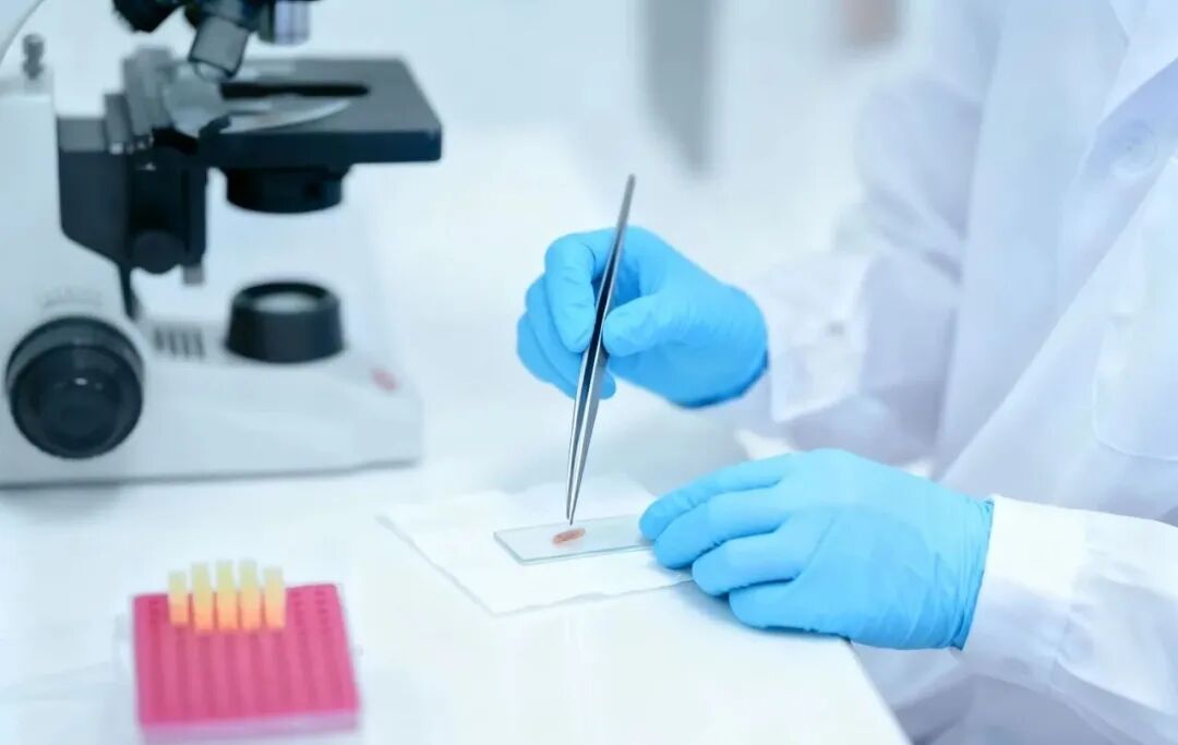 抽管血就能查50种癌？别急，离真正普及还有“三道坎”